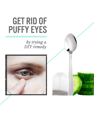 Cucumbers on Eyes and Other Home Remedies