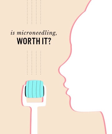 Is Microneedling Worth It?