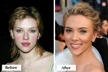 Scarlett Johansson