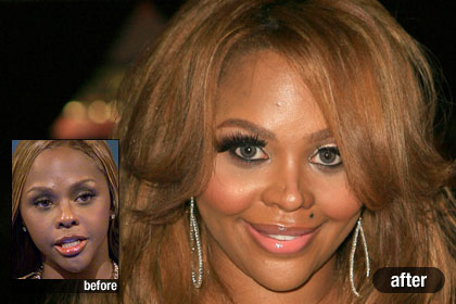 The Worst: Lil' Kim