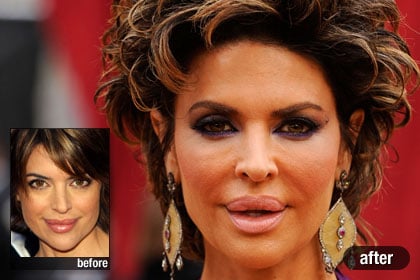 The Worst: Lisa Rinna