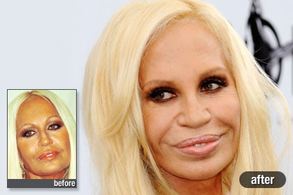 The Worst: Donatella Versace