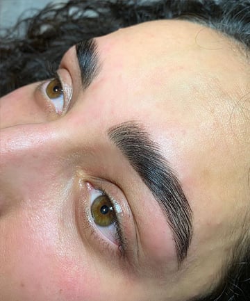 Post-Brow Lamination Procedures