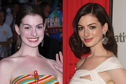 Anne Hathaway