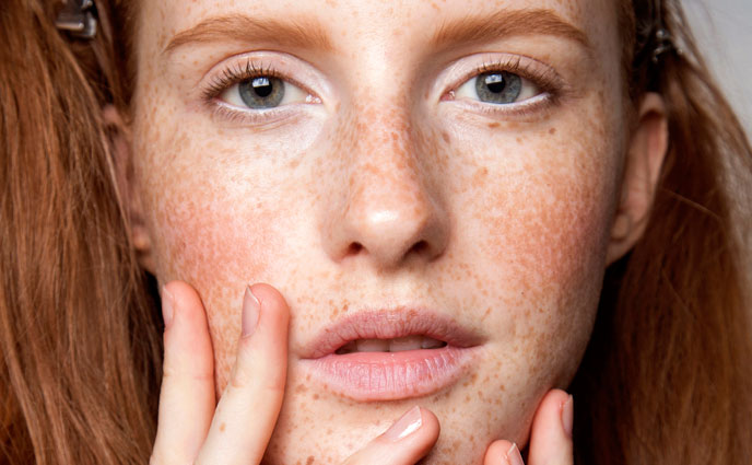 5 Signs Your Skin Is Aging Faster Than It Should — and What to Do About It