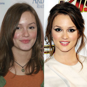 Celebrity Blah to Beautiful Transformations